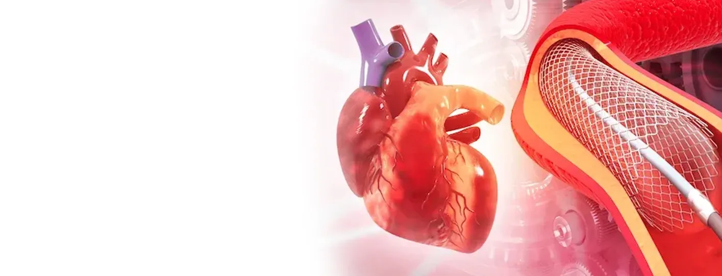 FAQs About Angioplasty Recovery in Patna
